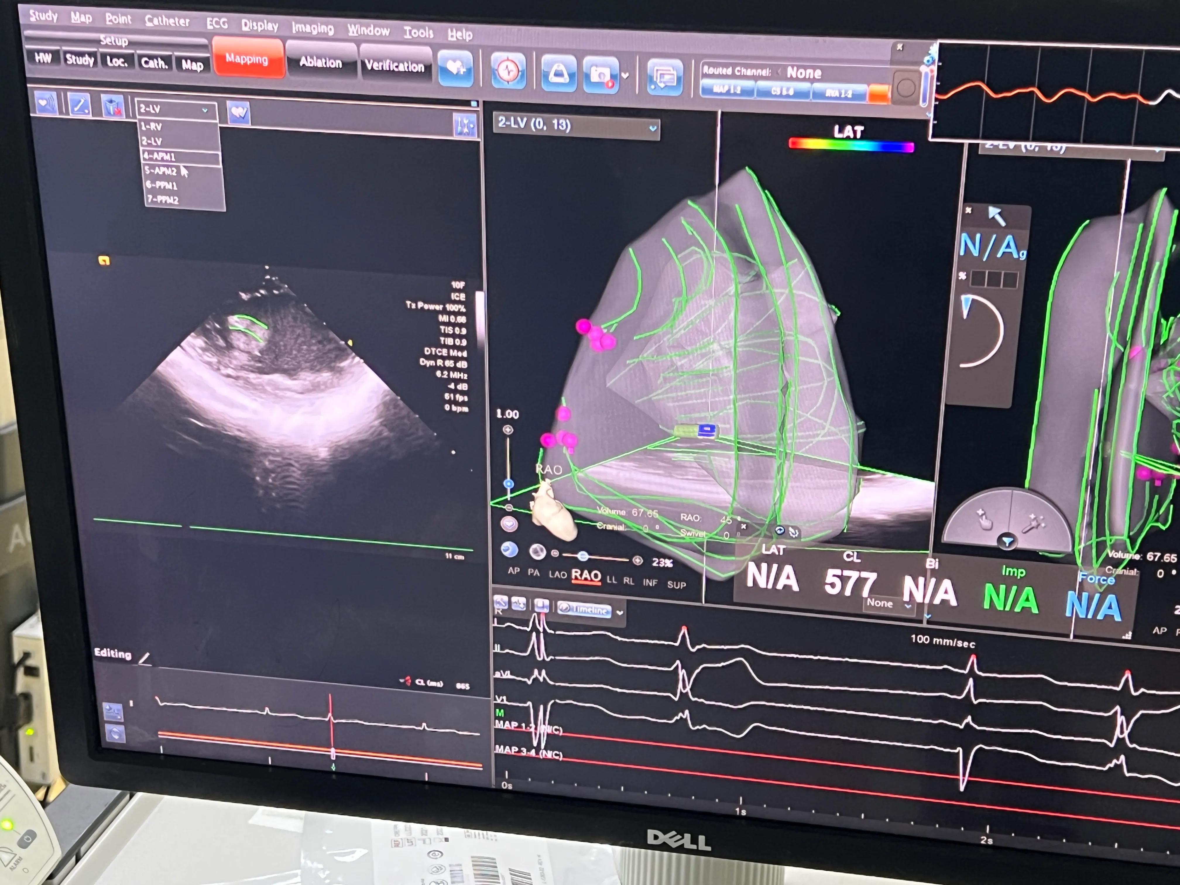 胸闷气促病例分析,小孩胸闷气短去检查说有炎症