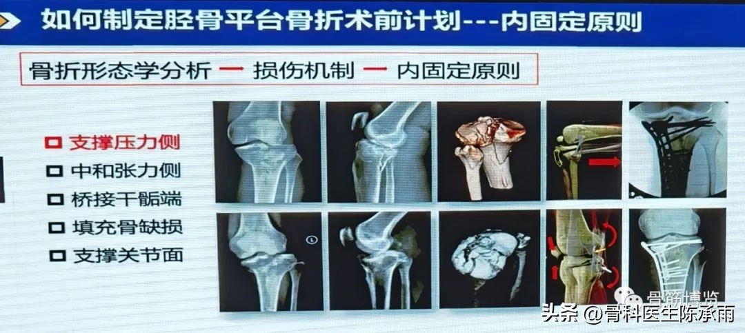 国家卫健委主办的骨创伤专项能力培训项目----下肢损伤学习班
