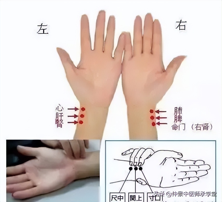 浮脉为什么主表证,浮脉主表