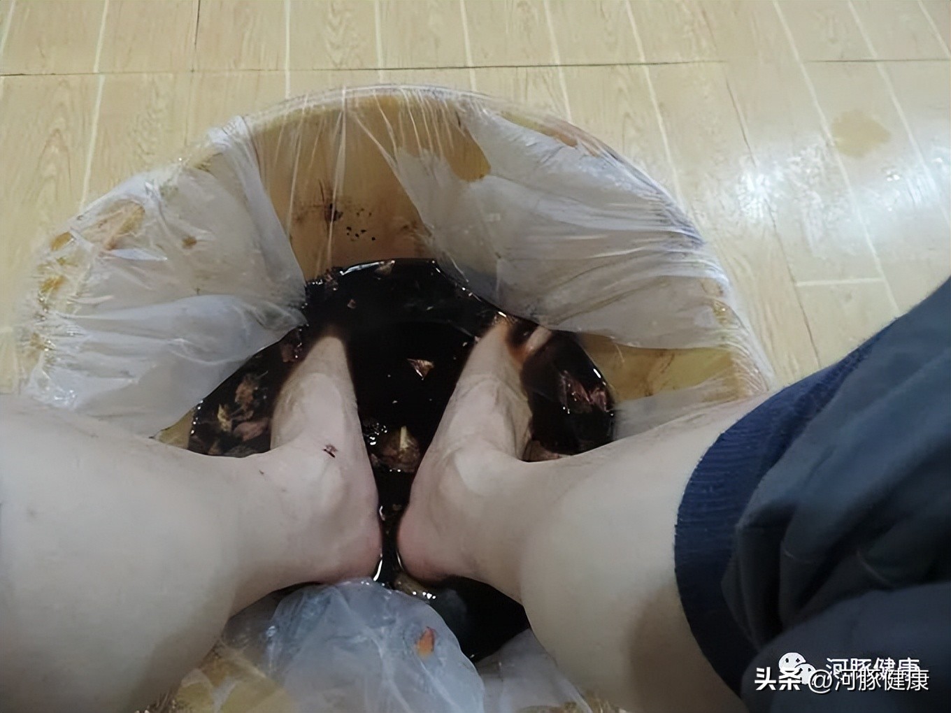 脚臭咋总是湿的,脚容易出汗还特别臭怎么去除脚臭