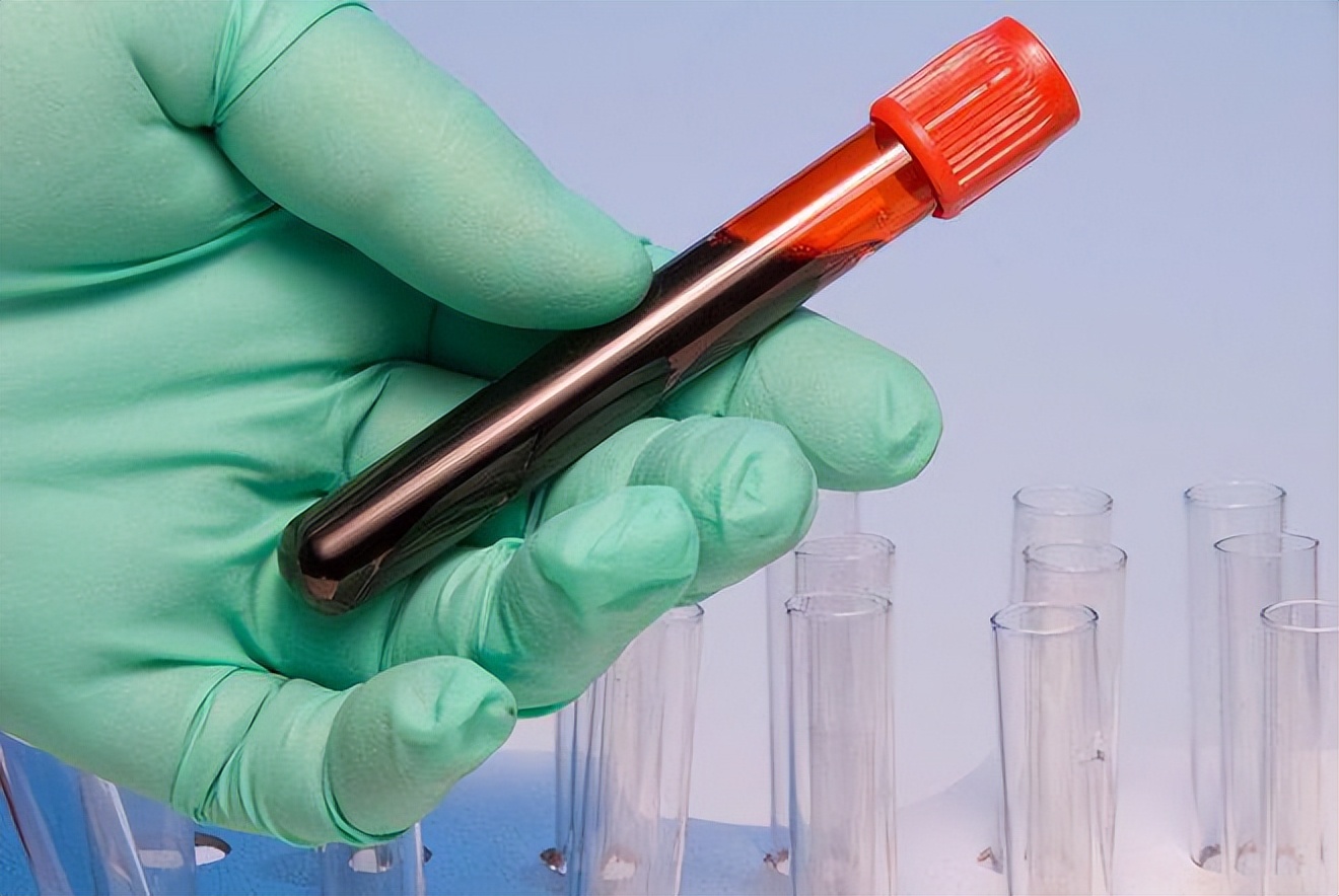 血型决定生命哪种血型易得癌症,o型血型寿命排行