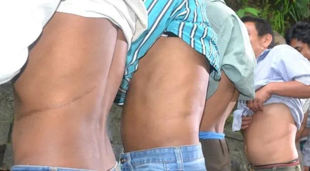 尼泊尔现“卖肾村”，因贫穷导致成年男女都跑去卖肾