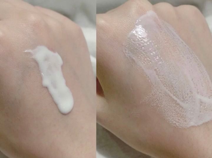 脸上长痘痘，如何正确的祛痘？