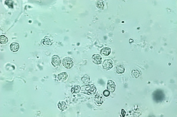 派特灵治妇科病吗,派特灵在妇科怎么使用