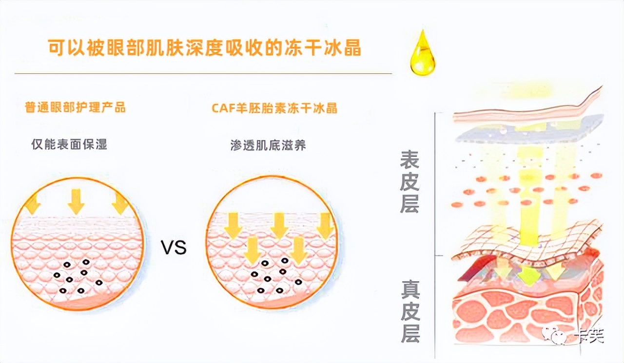 羊胚胎素冻干冰晶眼部精华液，平干纹，淡黑圈，收眼袋，美目传情