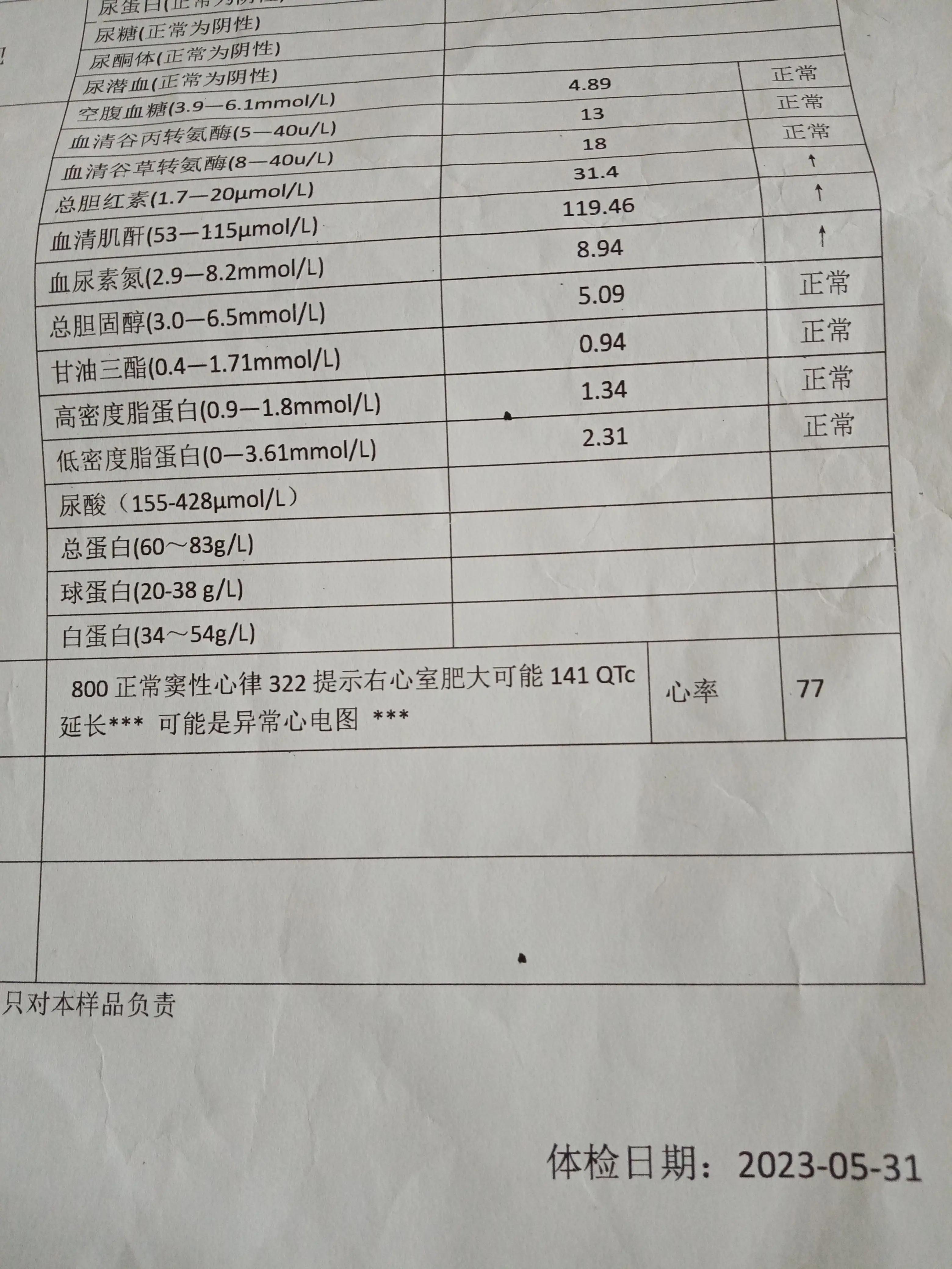 停药几天肝脏开始恢复,肝胆夜间恢复时间