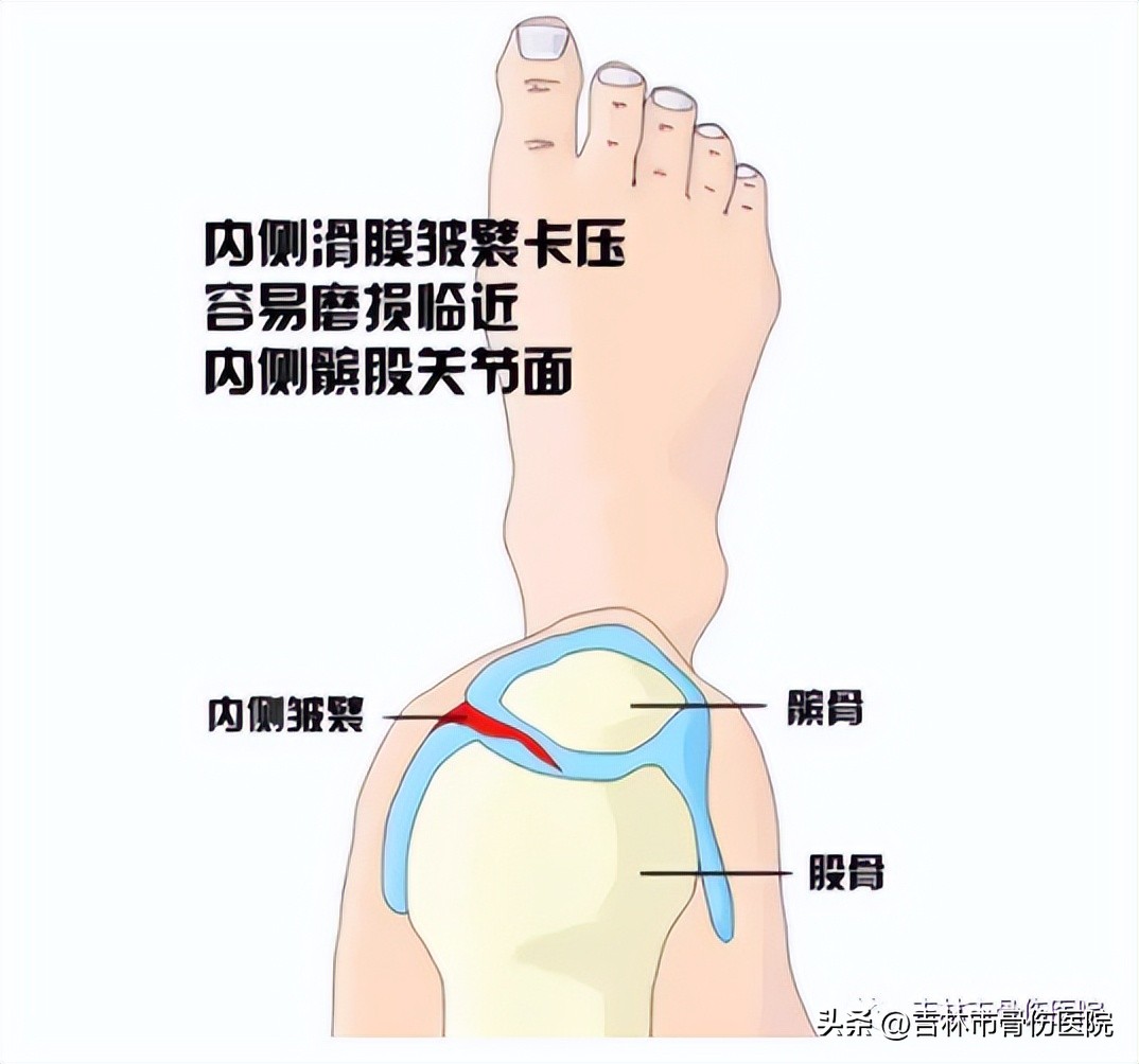 膝盖突然卡住了不能动是怎么回事,膝盖突然卡住怎么复原