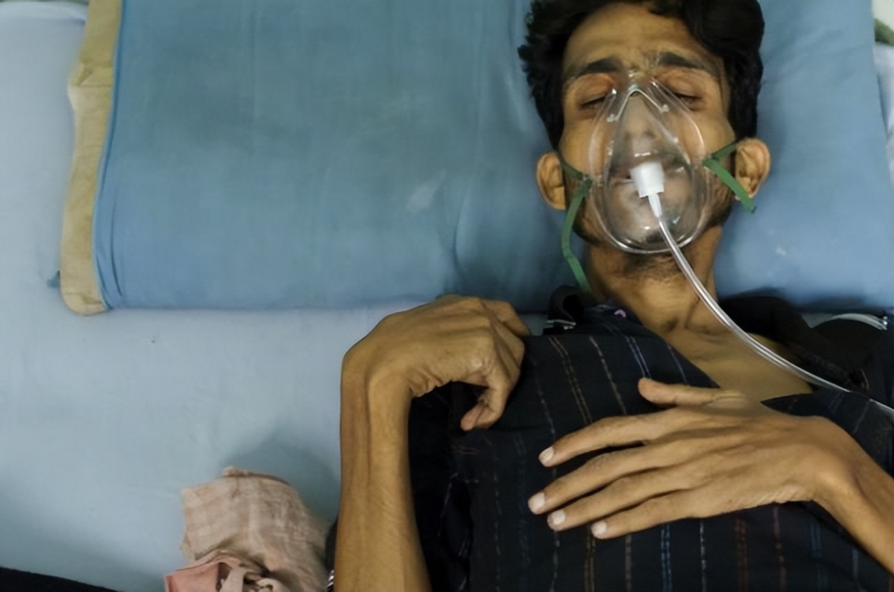 癌症不治疗医生大实话,发现癌症不能动手术