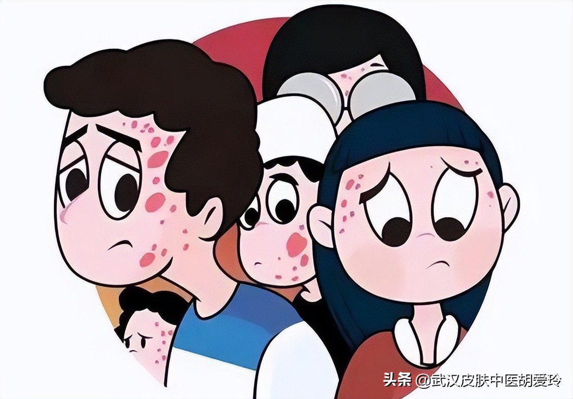 最近皮肤掉皮咋回事,身上像起皮一样是怎么回事