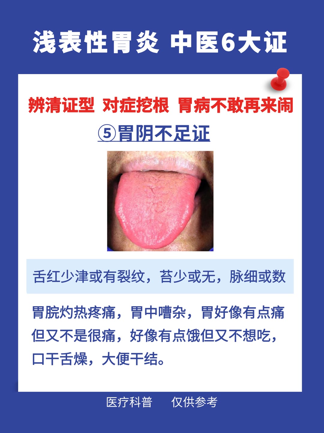 慢性浅表性胃炎中医治疗药方,浅表性胃炎中医判断