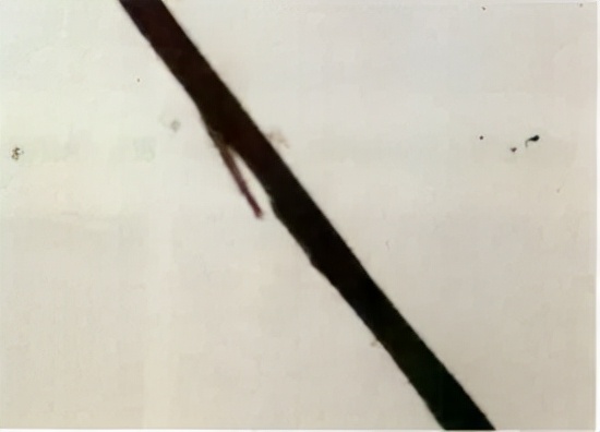 掉的头发根部没有小白点,头发根部小白点掉了还会长吗