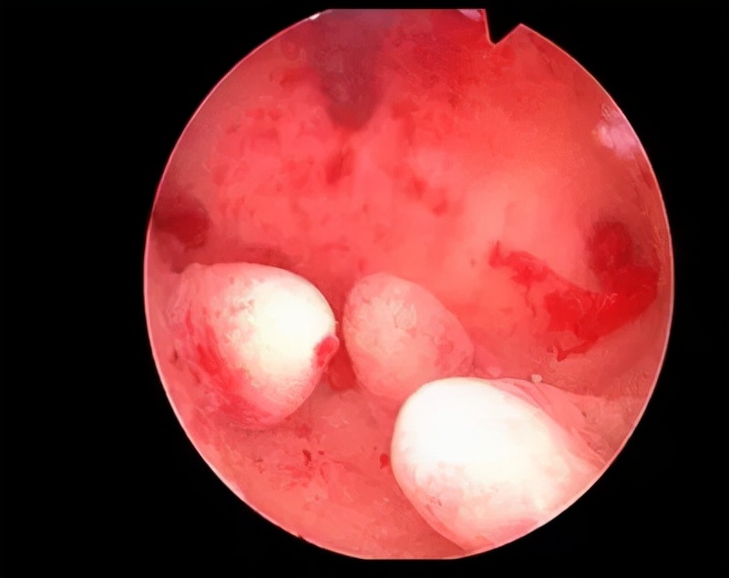 好医生被害案例,好医生结局解析