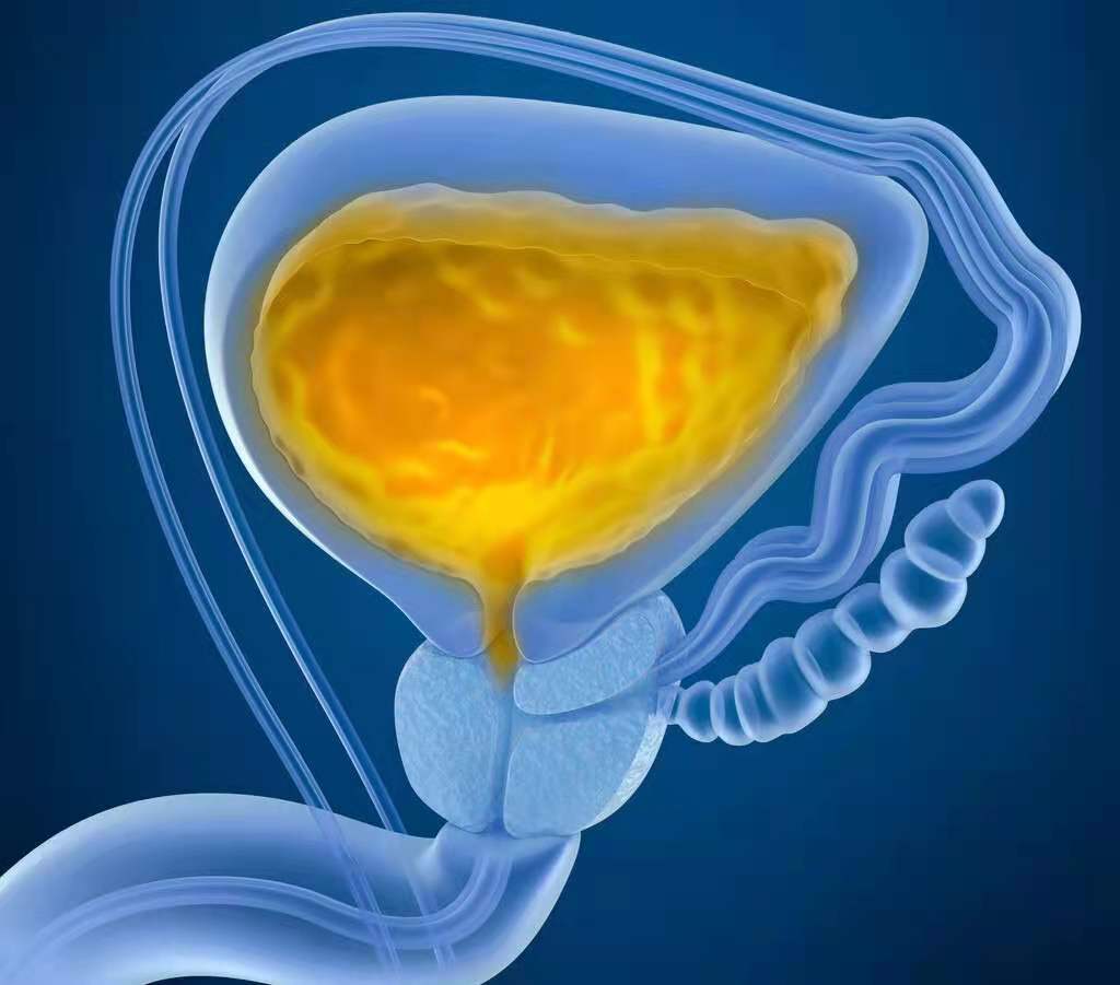 男性小便分叉是怎么回事,男性尿路粘连小便分叉