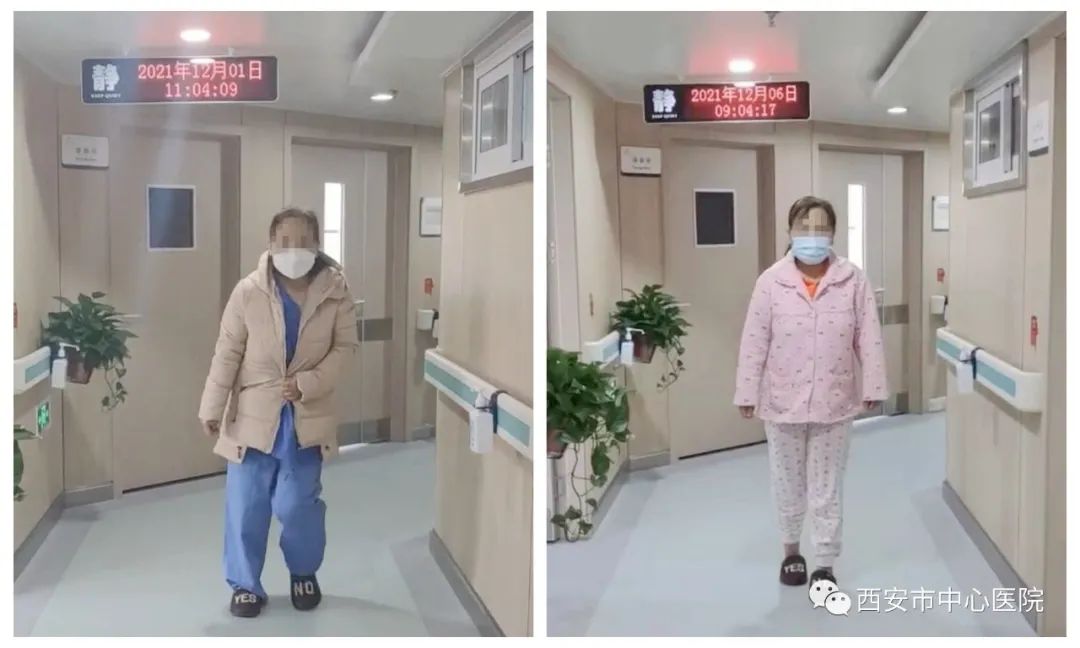 椎间孔镜治疗腰间盘突出视频,腰椎间盘突出做椎间孔镜腰胀痛