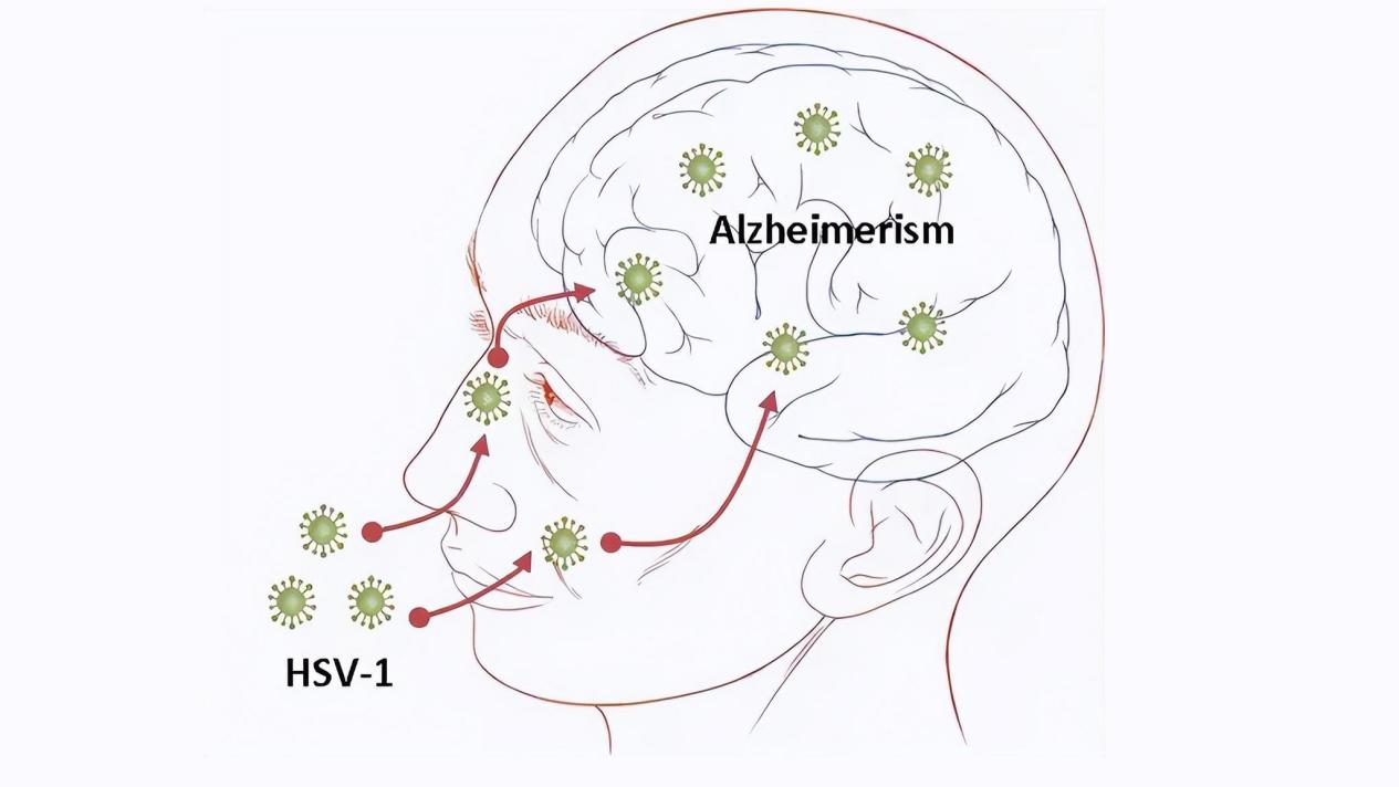 上火引起眼睛不适的症状有哪些,各种上火对应的症状及解决办法