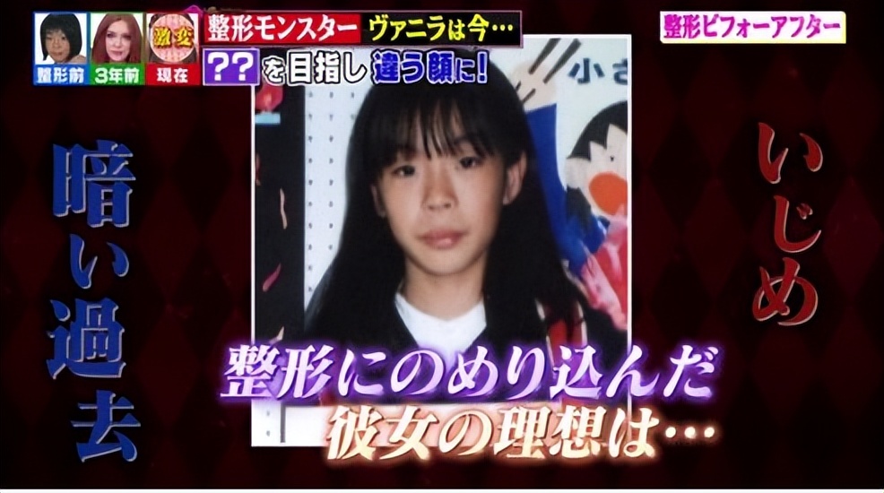 日本网红砸3亿整容上百次！整成法国娃娃：丑八怪在日本活不下去