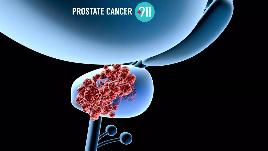 肿瘤领域的发展及看法,肿瘤临床试验有哪些平台