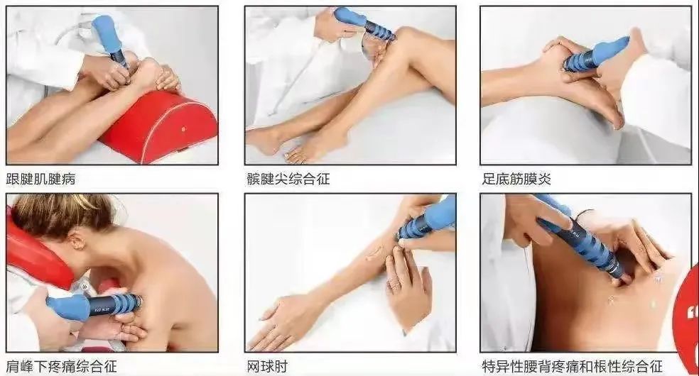 慢性疼痛理疗项目,慢性疼痛的新疗法