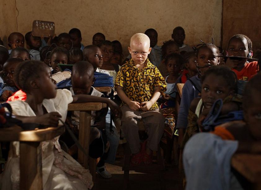 非洲版唐僧：血液堪比钻石，躯干价值126万元，警方24小时守卫