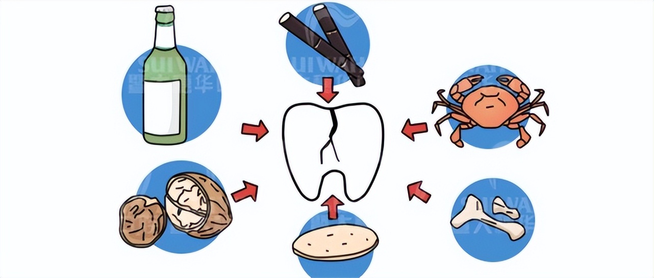 补牙后多久吃饭对牙修复更好,补牙后多久才能吃东西
