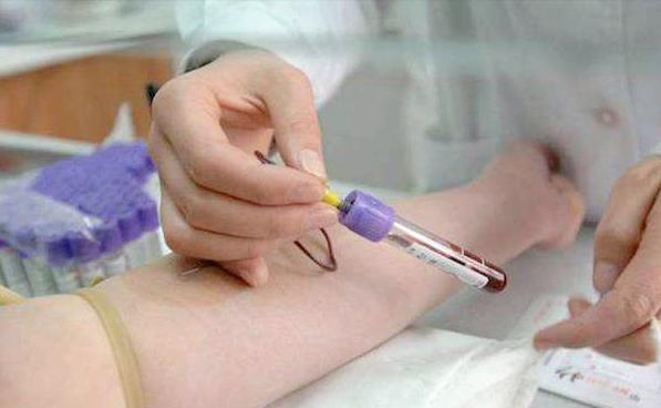 50岁大爷查不出五脏六腑,50岁大爷去体检找不到器官