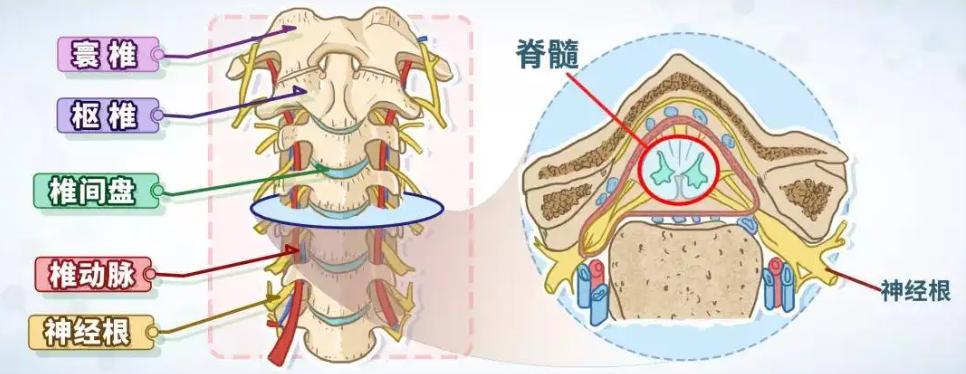 颈肩部神经痛的原因,颈肩腰腿疼麻木怎么回事