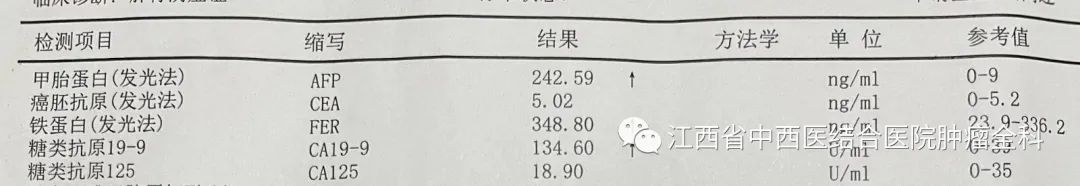 肝癌多发性肝内转移靶向药,肝癌中晚期免疫靶向有奇迹出现吗