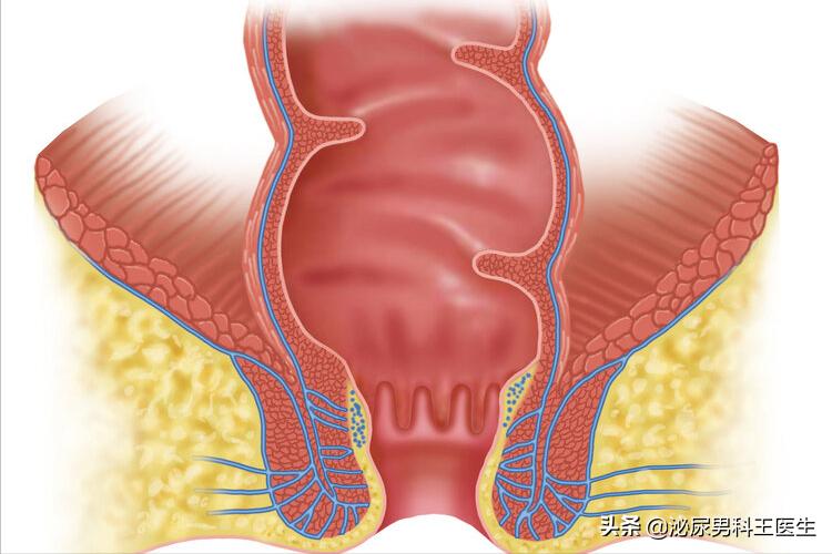 “难以启齿”的肛管癌，你了解它吗？出现3个症状，及时就医检查