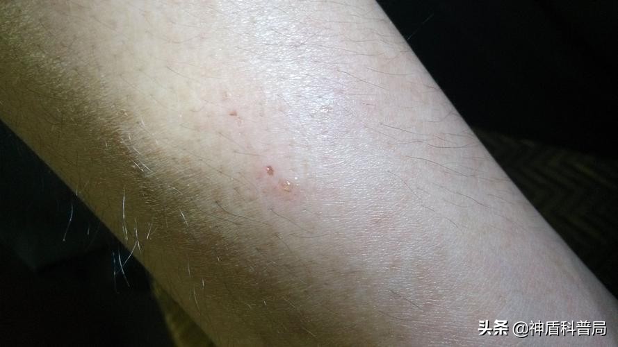 渭南21岁女孩被银环蛇咬死,陕西银环蛇咬伤21岁女子