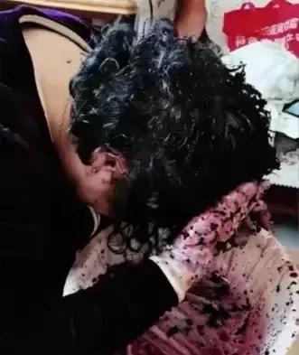 大妈用桑葚染发后续,大妈在家用桑葚染头发