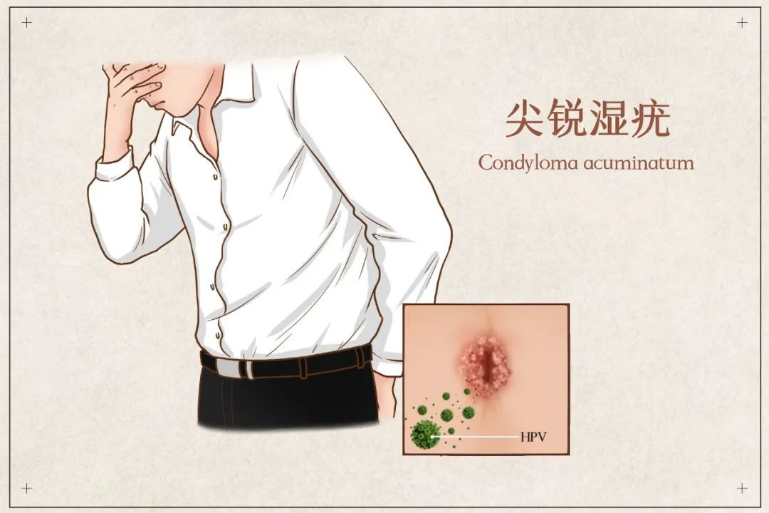 女性hpv感染多久才有可能转宫颈癌,80%女性会在一生中感染过hpv