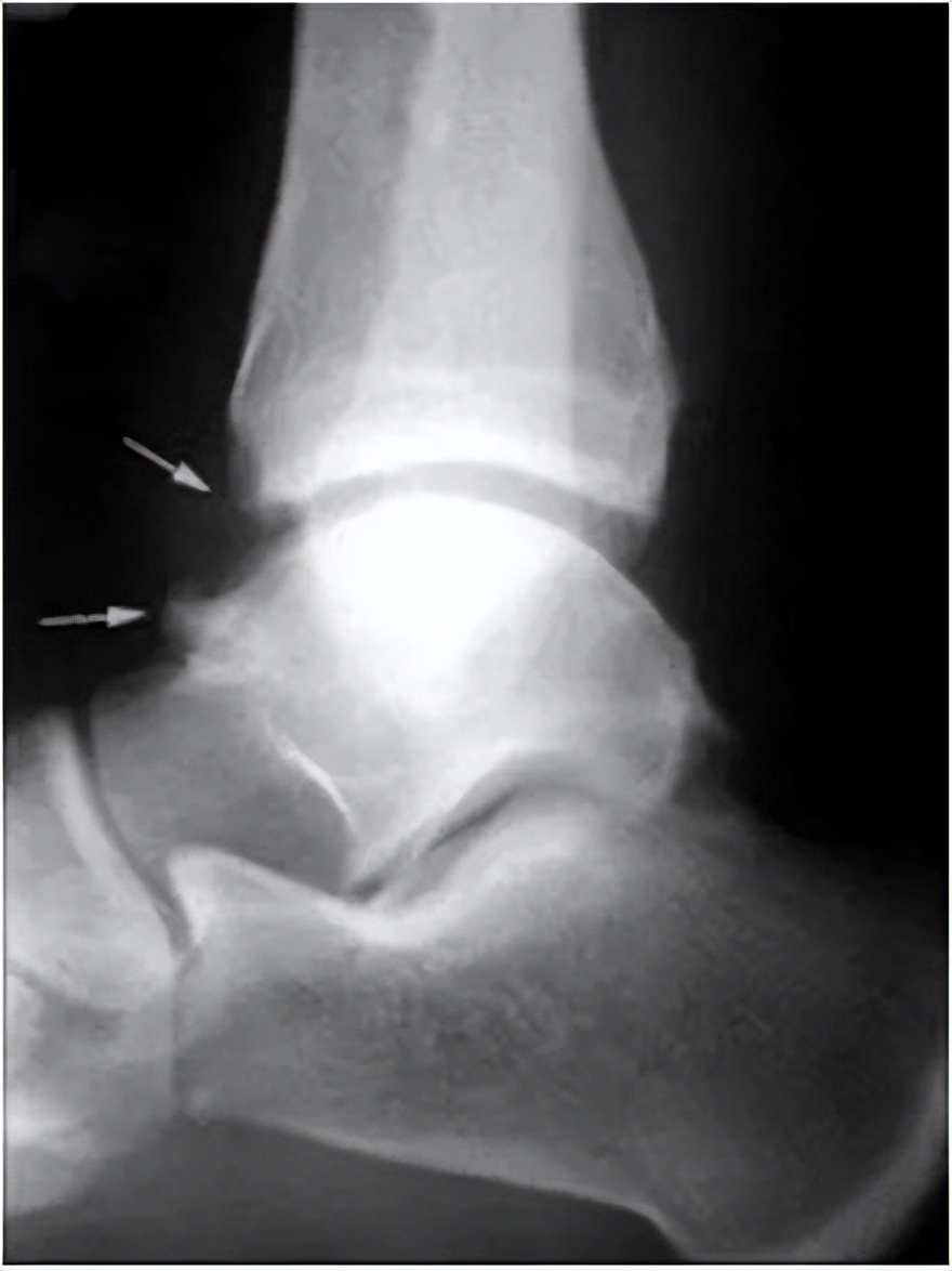 世界杯踢足球的热情,世界杯引发的足球热