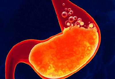 胃不舒服胃酸怎么缓解,大吃大喝过后怎么补救