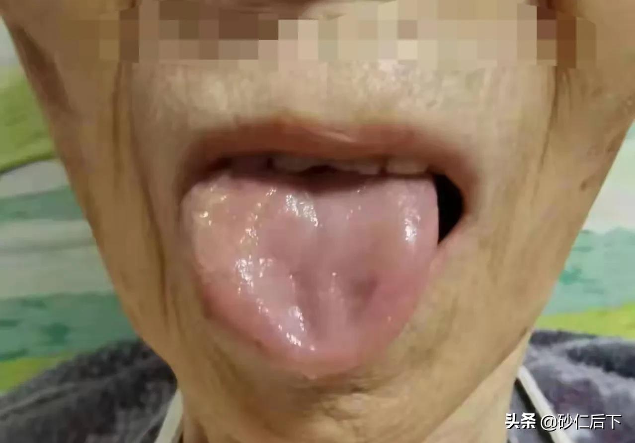 学习中医舌诊知识,舌红苔滑脉细数