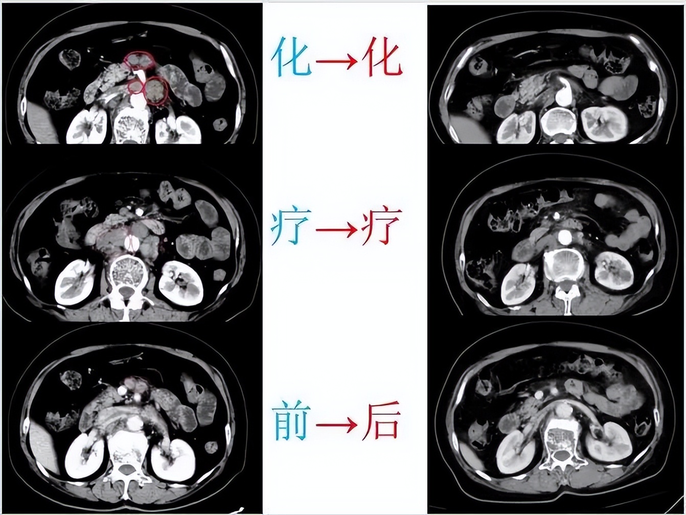 鹰潭184医院能治颈椎病吗,江西鹰潭184医院新进展