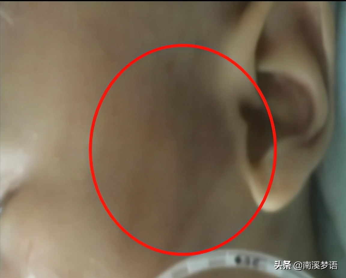 2015年，2个月大婴儿遍体鳞伤，亲生父亲“我打我孩子有什么错”