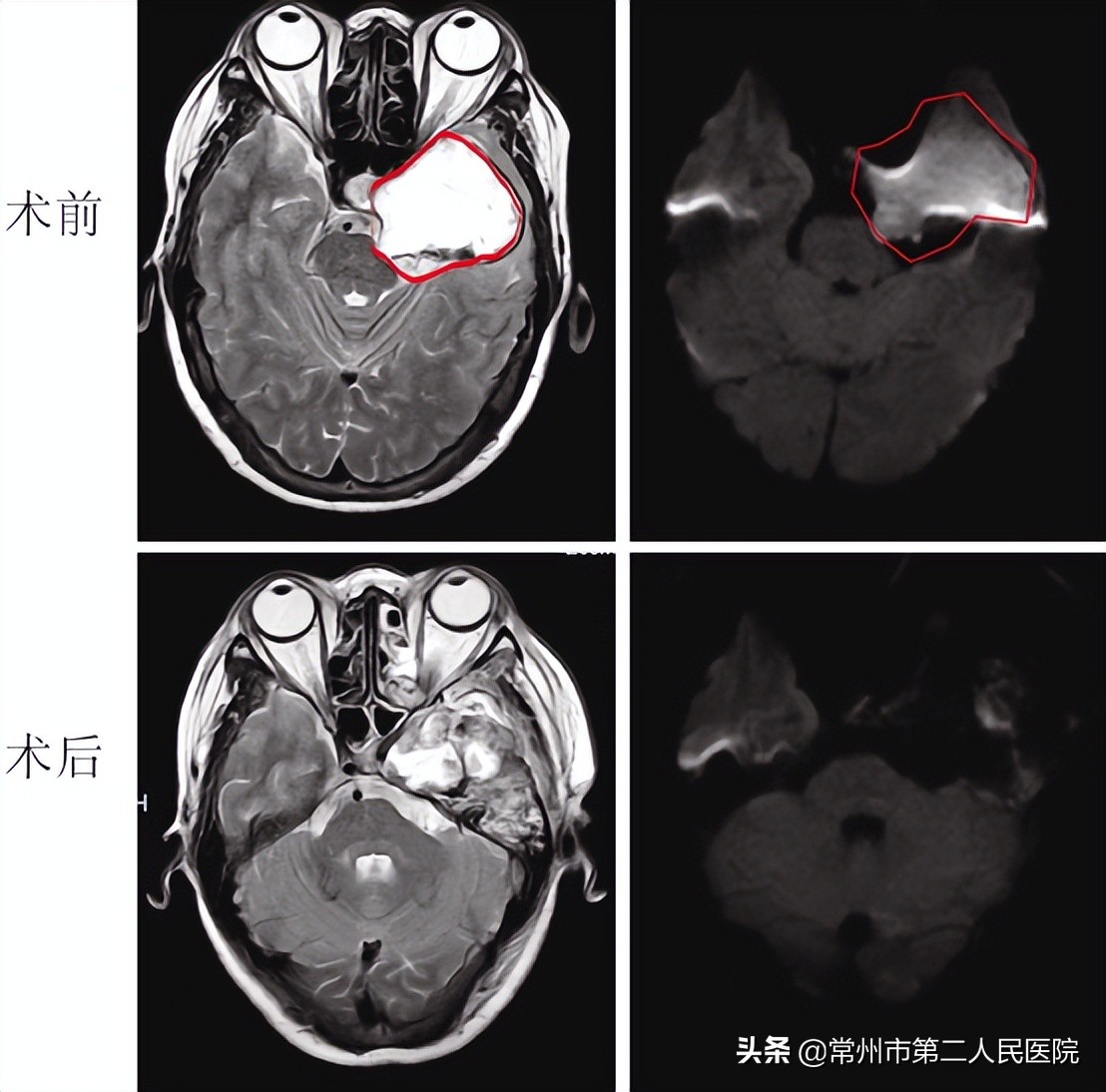 寻医30年的视频,疑难杂症寻医问诊