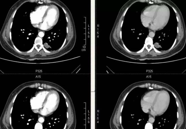 烟瘾酒瘾是心理作用还是身体感受,烟瘾和酒瘾原因
