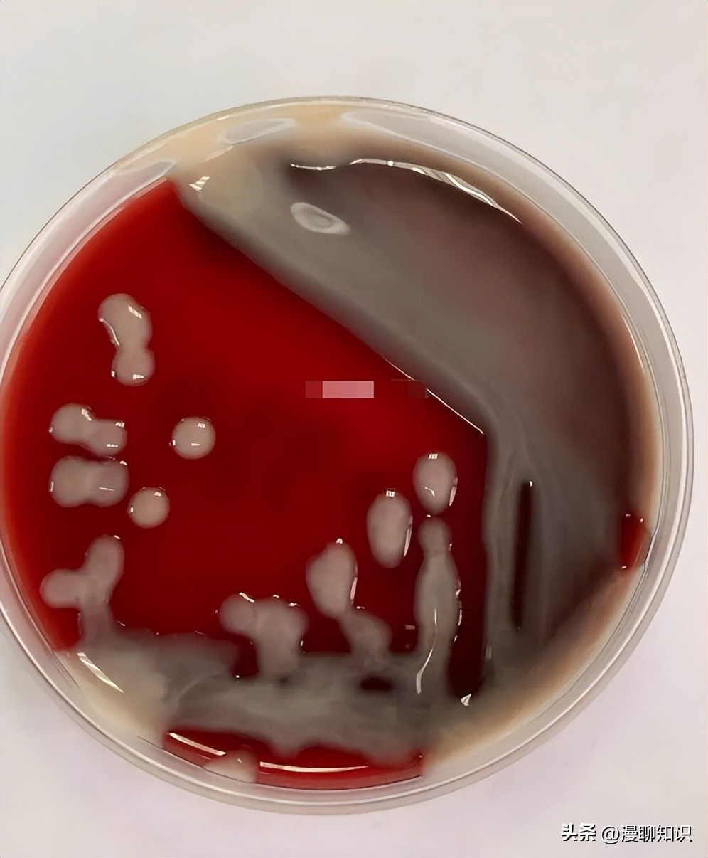 老年人得了肺炎应如何有效医治,肺炎有多严重怎么办