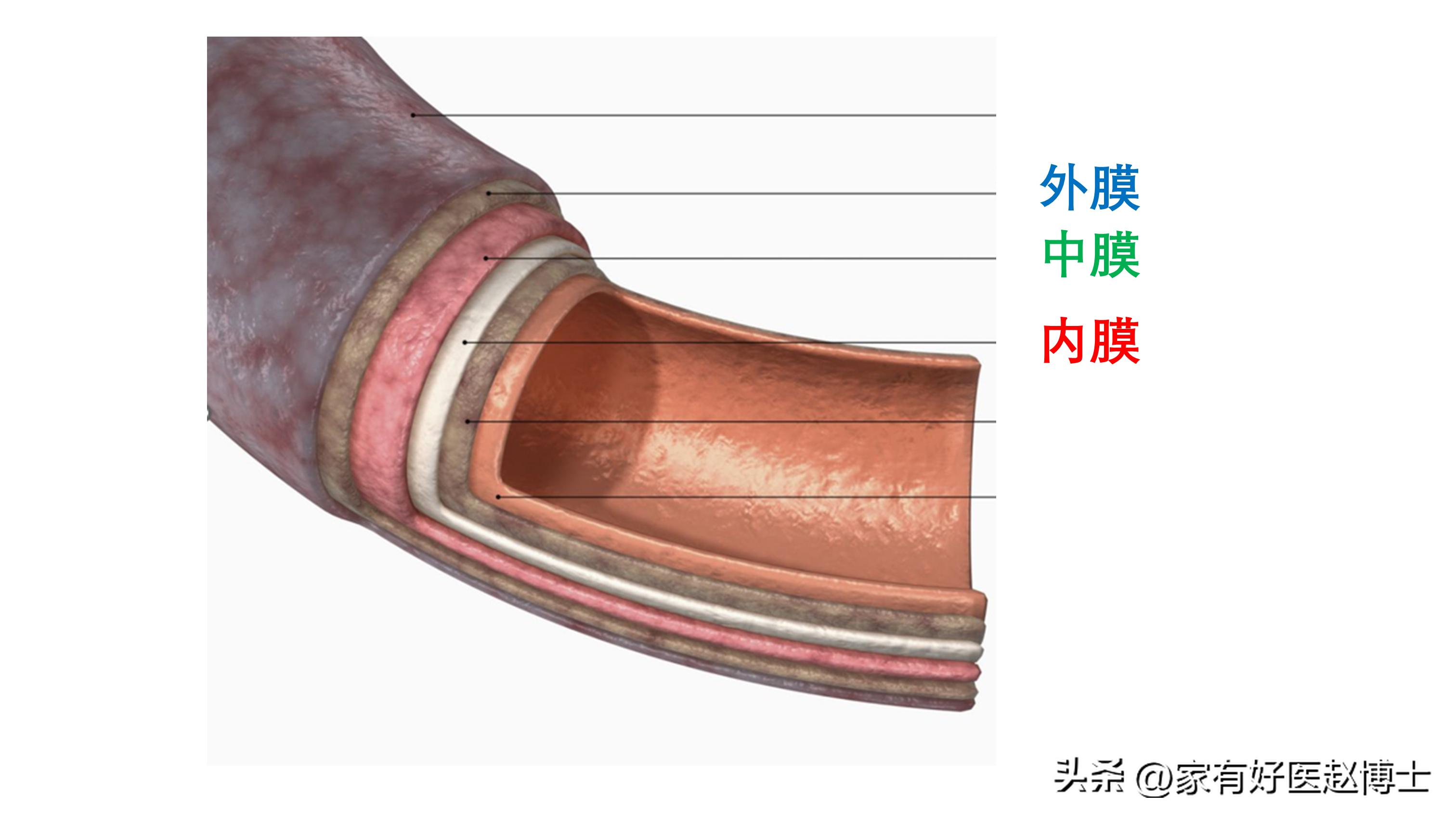 体检提示心血管局部钙化,体检发现冠脉见钙化影是什么意思