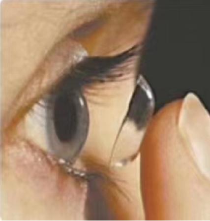 摘下隐形眼镜视力模糊,摘隐形眼镜不小心揪到眼睛很模糊
