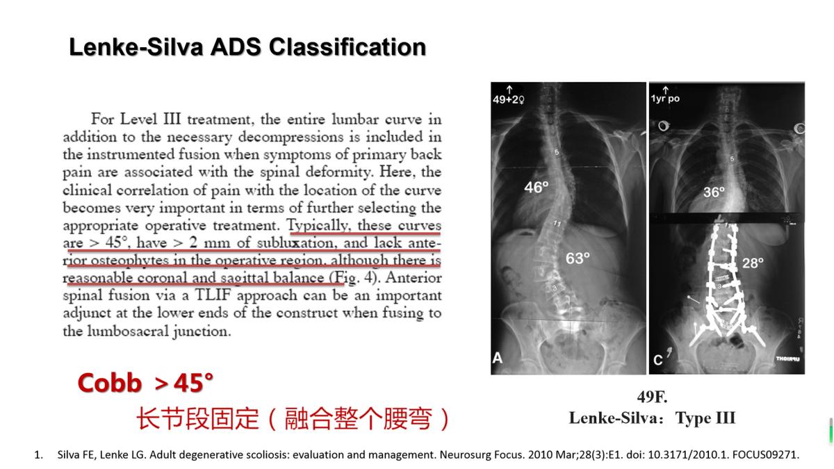 老年人脊柱侧弯的危害和症状,老人脊柱侧弯腰部疼痛怎么缓解