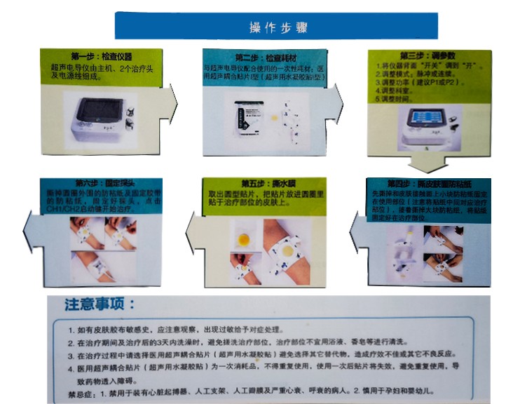 超声药物透入治疗仪视频,超声药物透入治疗仪适应症
