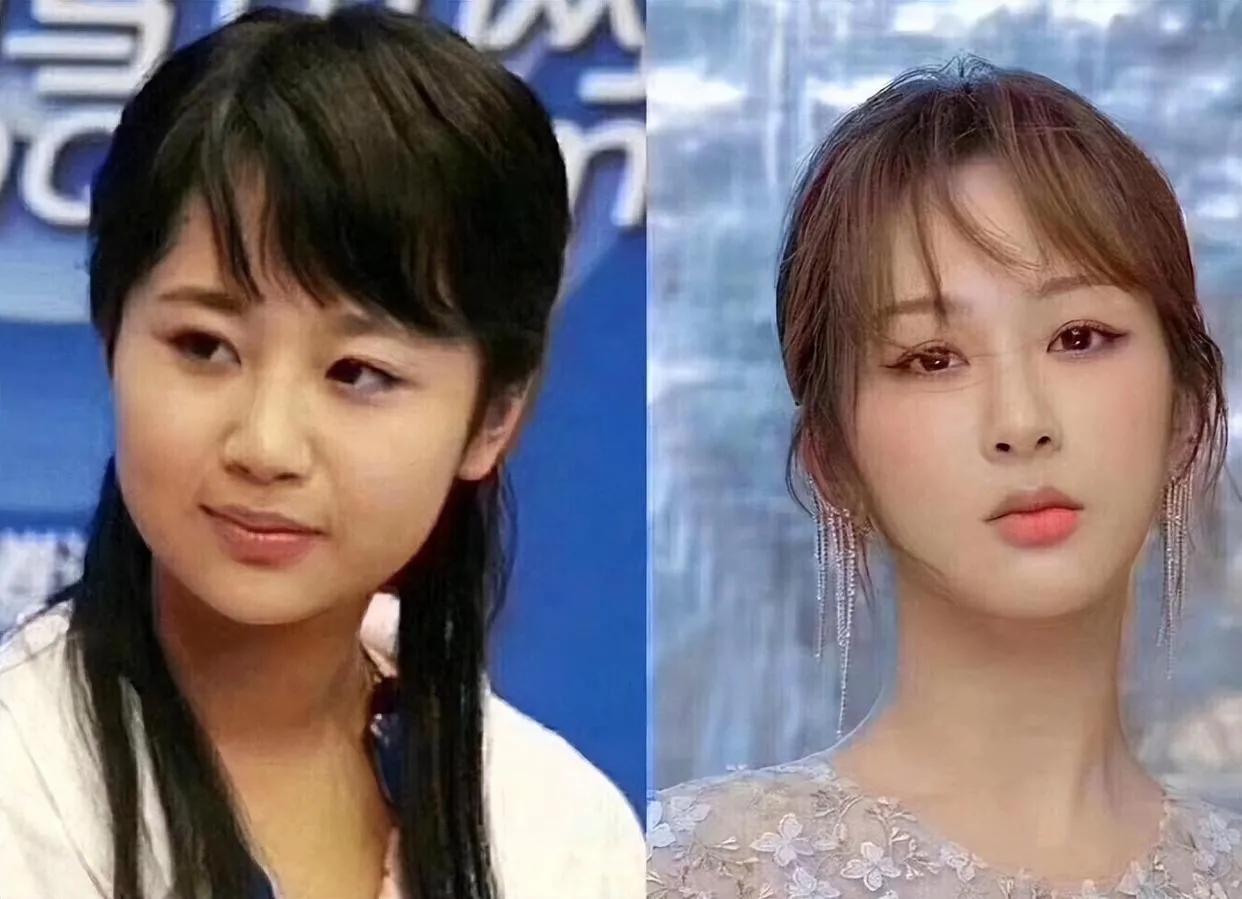 娱乐圈天然脸vs整容脸,娱乐圈没有整容的人纯天然的脸