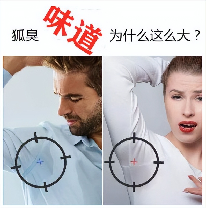 得了狐臭怎么办,狐臭手术后需要注意什么