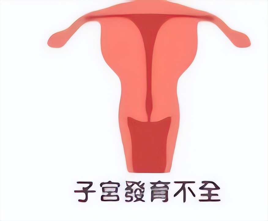 七种子宫形状，你了解过吗？