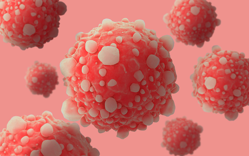 睡醒了全身酸痛无力没精神怎么办,全身酸痛无力整天睡不醒怎么回事