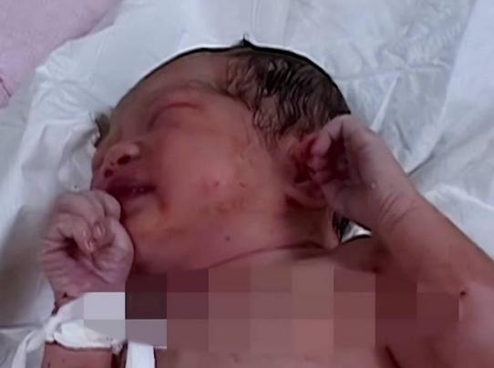 婴儿出生犯毒瘾,新生儿犯毒瘾