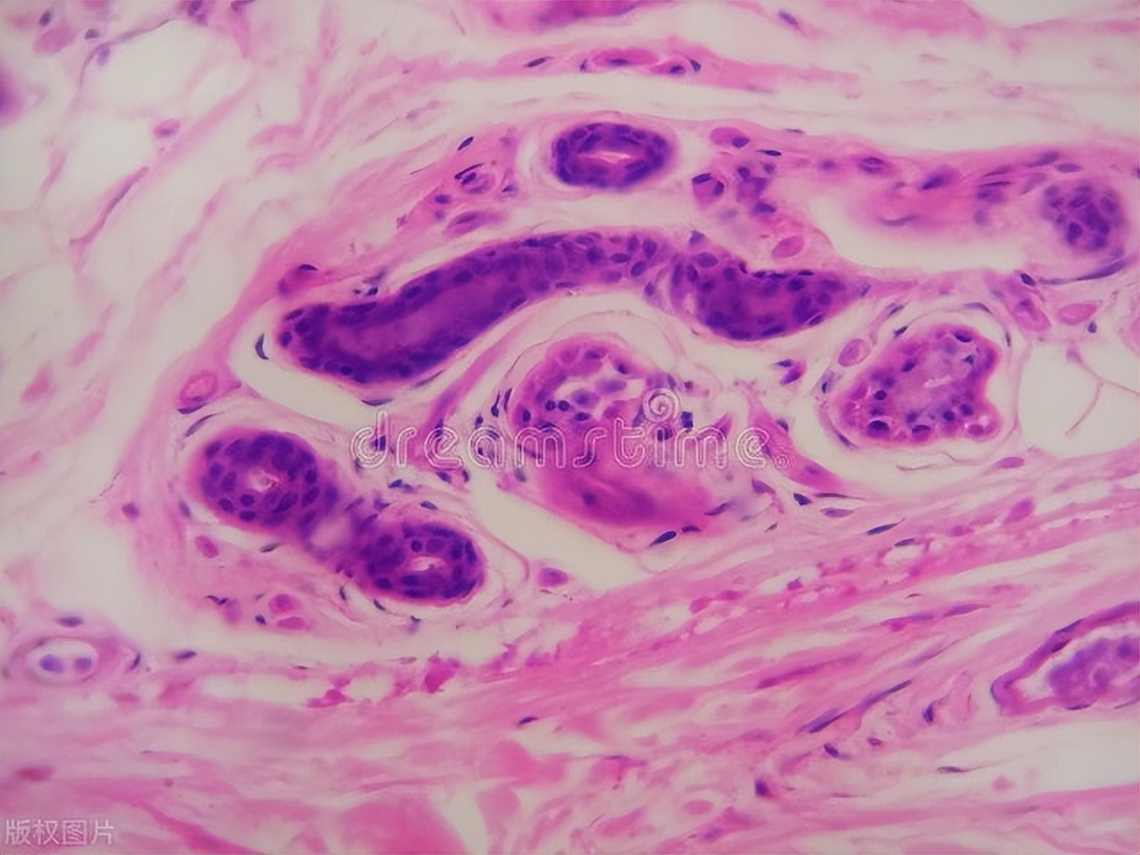 为什么“菊花”周围也会长“毛”？刮掉会怎样？不要害羞都应了解