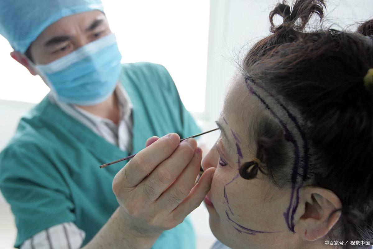 拉皮手术的6个秘密,有做过小拉皮手术的真实案例